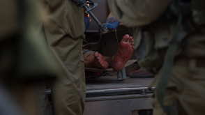חטמר 474 פינוי פצועים סורים